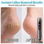 🏖️Summer Cool Deal: 60% OFF!!👍🎉 5-Speed Electric Foot Renewal System