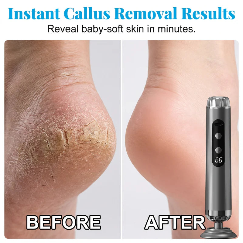 🏖️Summer Cool Deal: 60% OFF!!👍🎉 5-Speed Electric Foot Renewal System